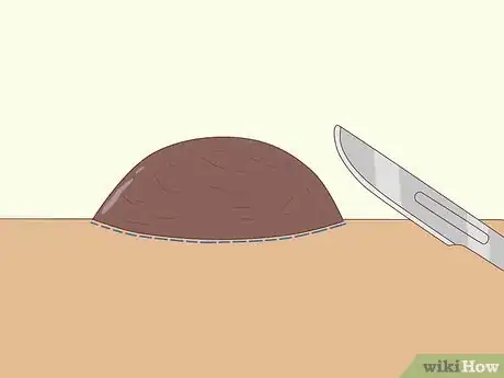 Image titled Get Rid of Moles on Your Face Step 5