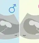 Tell if You're Pregnant with a Girl or Boy