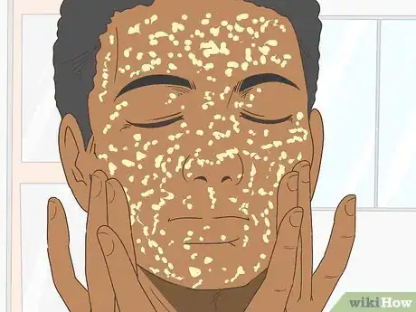 Image titled Make a Honey and Sugar Face Scrub Step 13