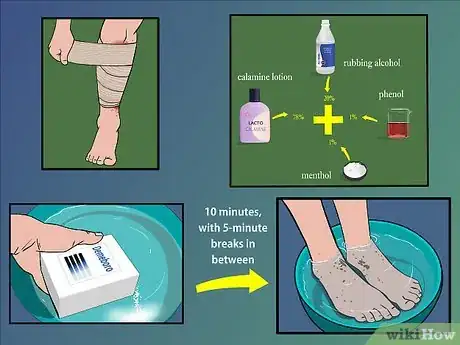 Image titled Treat Shingles (Herpes Zoster) Step 7