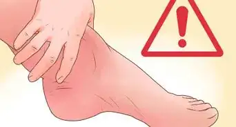 Cure a Swollen Ankle