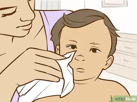 Image titled Treat Neck Rashes for Your Baby Step 8