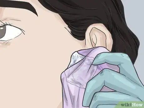 Image titled Pierce Your Ear with a Safety Pin Step 6