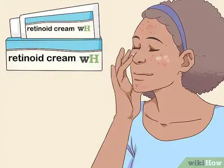 Image titled Get Rid of Acne Fast Step 4