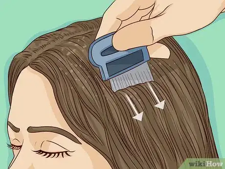 Image titled Remove Nits from Hair Step 6