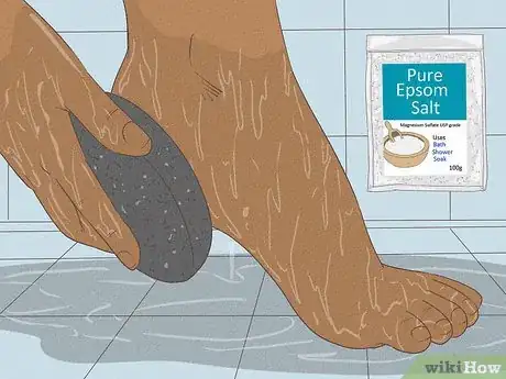 Image titled Get Rid of Dry Skin on Feet Step 1