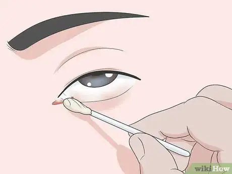 Image titled Get Sand Out of Your Eyes Step 10