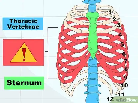 Image titled Assess a Rib Fracture Step 1