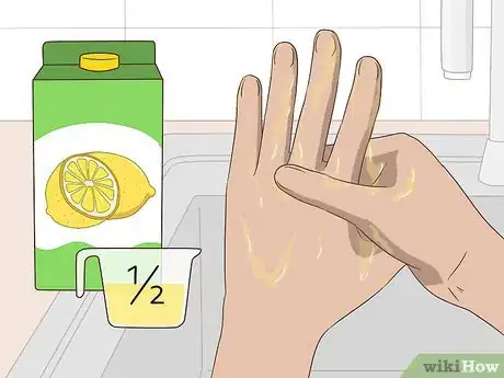 Image titled Get Stain Off Your Hands Step 7