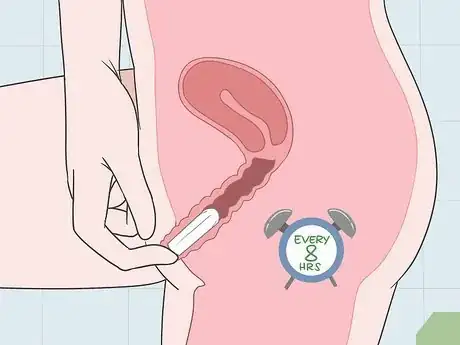 Image titled Prevent Leaks on Your Period Step 7