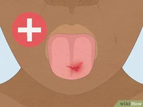 Image titled Heal a Cut on Your Tongue Step 13