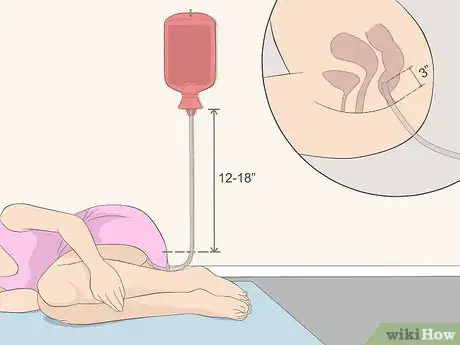 Image titled Make an Enema Step 9