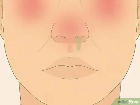 Image titled Make Saline Nasal Spray Step 16