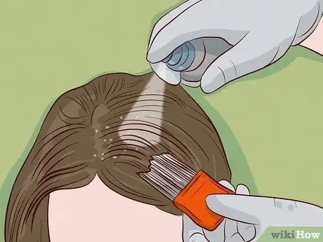 Image titled Get Rid of Lice Step 10