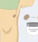 Remove Moles Quickly