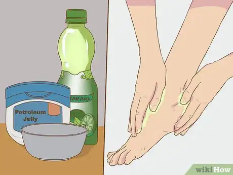 Image titled Remove Dead Skin from Feet Step 9