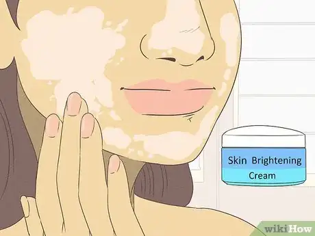 Image titled Get Rid of Spots on Your Skin Step 4