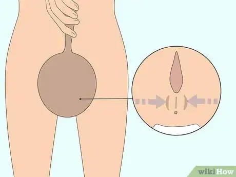 Image titled Do Kegel Exercises Step 3