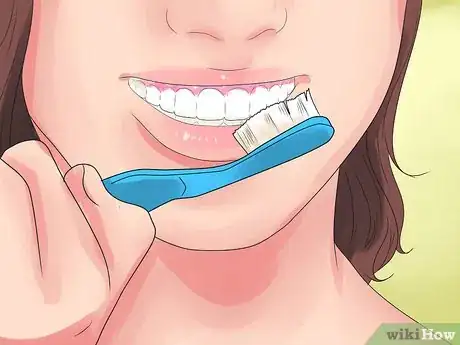 Image titled Alleviate Orthodontic Brace Pain Step 14