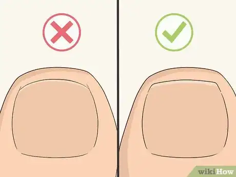 Image titled Give Yourself a Pedicure Using Salon Techniques Step 8