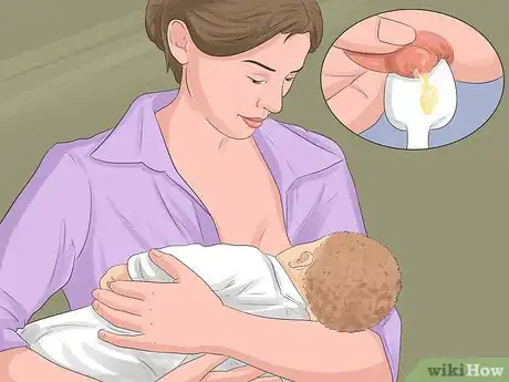 Image titled Prevent Jaundice in Newborns Step 3