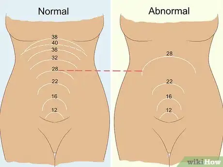 Image titled Measure Fundal Height Step 8