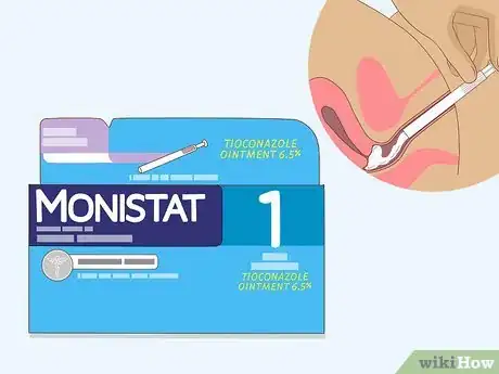 Image titled Apply Monistat Step 11