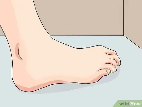 Image titled Identify Achilles Tendinitis Step 4