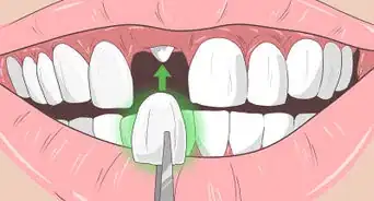 Remove Brown Stains from Teeth