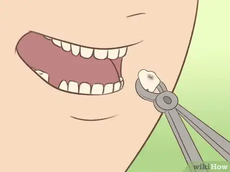 Image titled Alleviate Toothache Pain Step 11