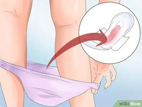 Image titled Stop Vaginal Bleeding During Pregnancy Step 1