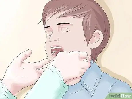 Image titled Know if Your Child Has Scarlet Fever Step 1