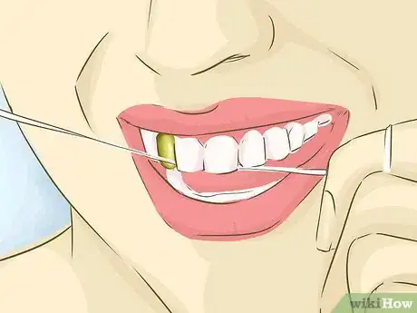 Image titled Clean Gold Teeth Step 2