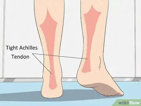 Image titled Fix Flat Feet Step 2