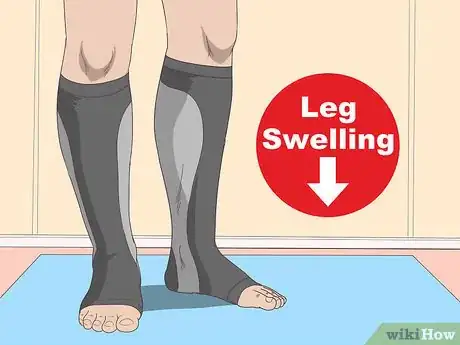 Image titled Reduce Leg Swelling Step 8