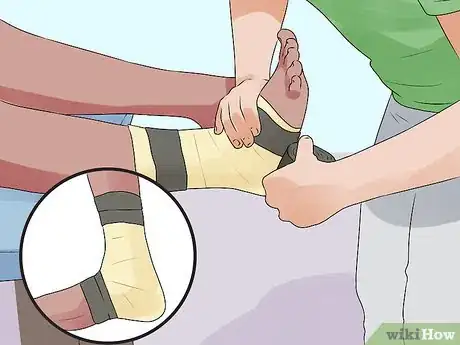 Image titled Tape an Ankle Like an Athletic Trainer Step 7