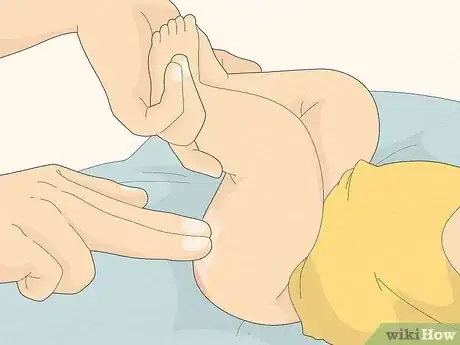 Image titled Use Coconut Oil for Diaper Rash Step 3