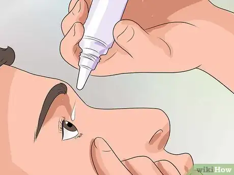 Image titled Get Rid of Pink Eye Fast Step 5