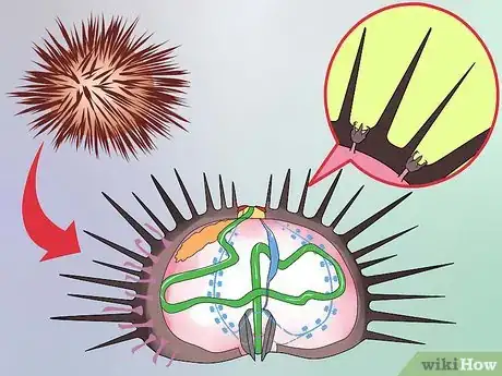 Image titled Treat a Sea Urchin Sting Step 2