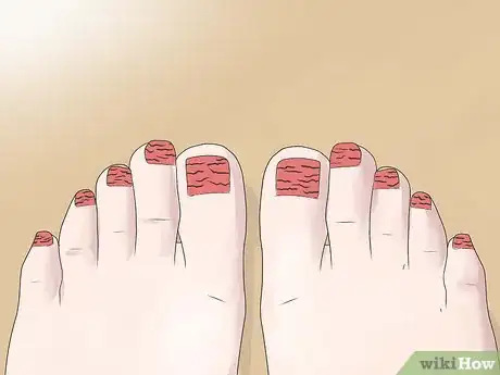 Image titled Perform a Professional Salon Pedicure Step 18