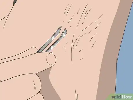 Image titled Reduce Body Hair Growth Step 13