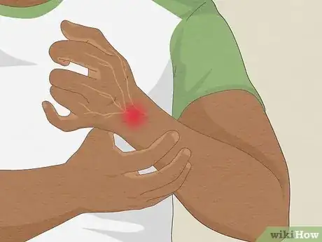 Image titled Know if Left Arm Pain Is Heart Related Step 7