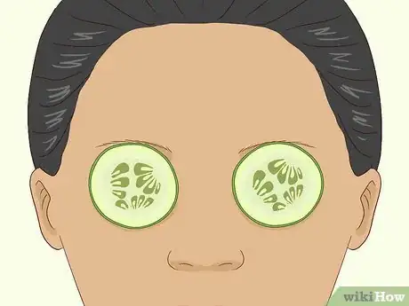 Image titled Get Rid of Puffy Eyelids Step 3