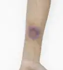 Make a Fake Bruise with Makeup