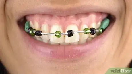 Image titled Make Fake Braces Step 8