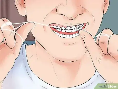 Image titled Stop Fiddling with Your Braces Step 10