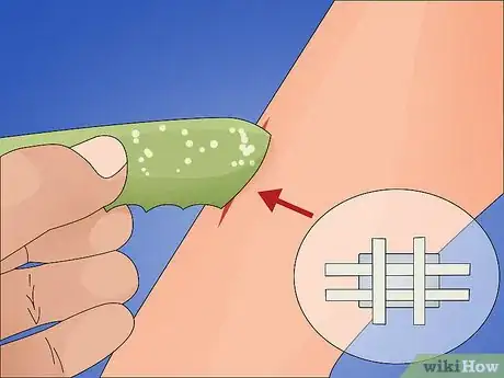 Image titled Make a Quick Disinfectant for Minor Cuts and Abrasions Step 10