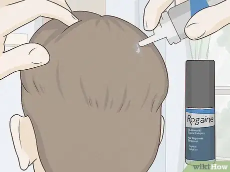 Image titled Regrow Hair Naturally Step 17