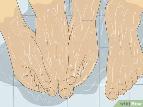 Image titled Get Rid of Dry Skin on Feet Step 9