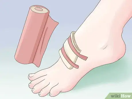 Image titled Get Rid of a Scab Step 1